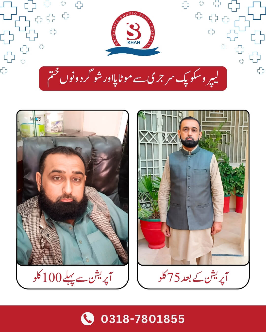 bariatric surgery success stories