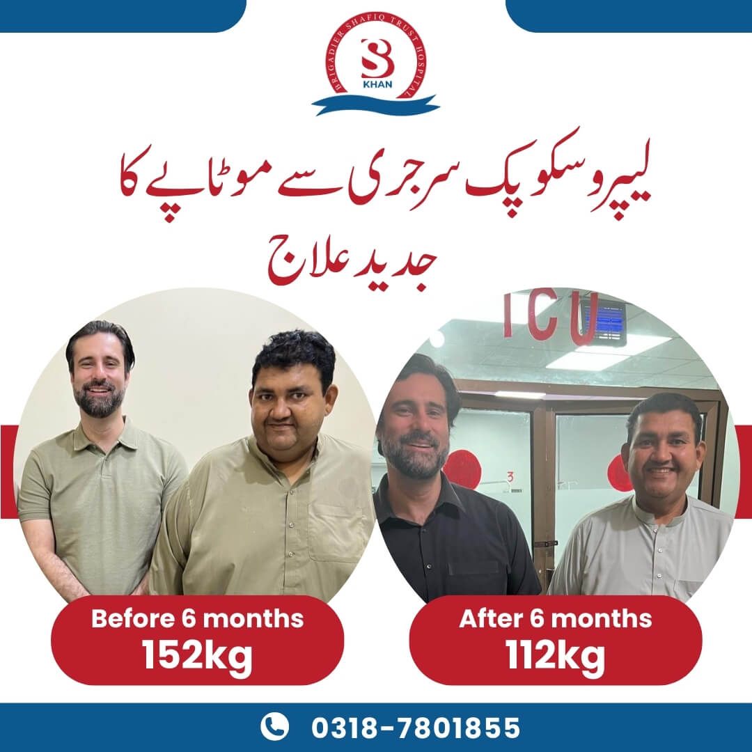 bariatric surgery transformation photos