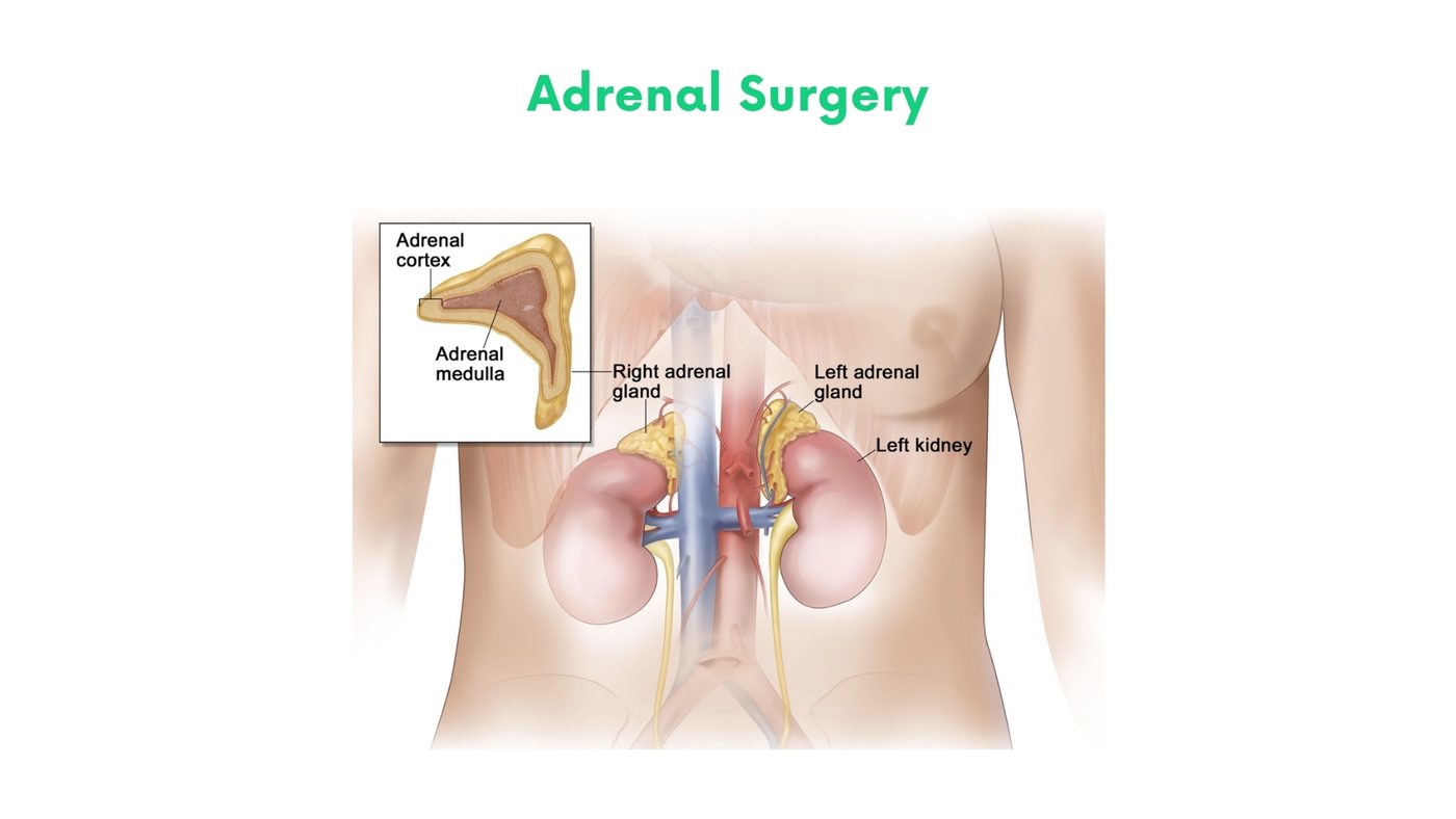 Adrenal Surgery in Bhakkar by Dr. Shehryar Niazi