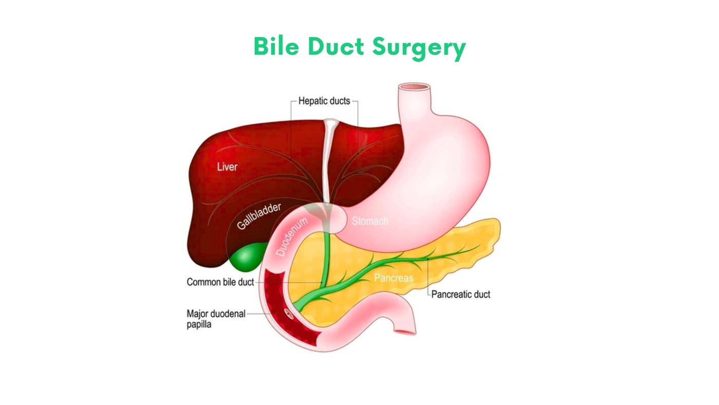 Laparoscopic bile duct surgery (CBD exploration, choledochoduodenostomy) in Bhakkar by Dr. Shehryar Niazi