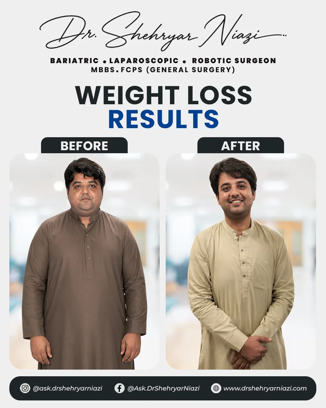 Weight loss surgery before and after result 2, bariatric patient of Dr. Shehryar Niazi