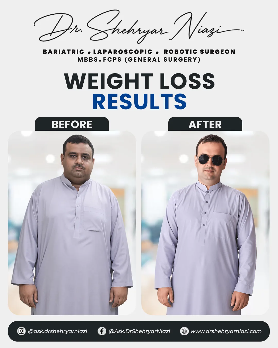 Weight loss surgery before and after result 3, bariatric patient of Dr. Shehryar Niazi