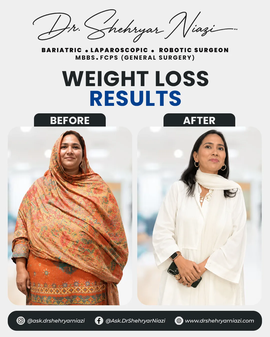 Weight loss surgery before and after result 4, bariatric patient of Dr. Shehryar Niazi