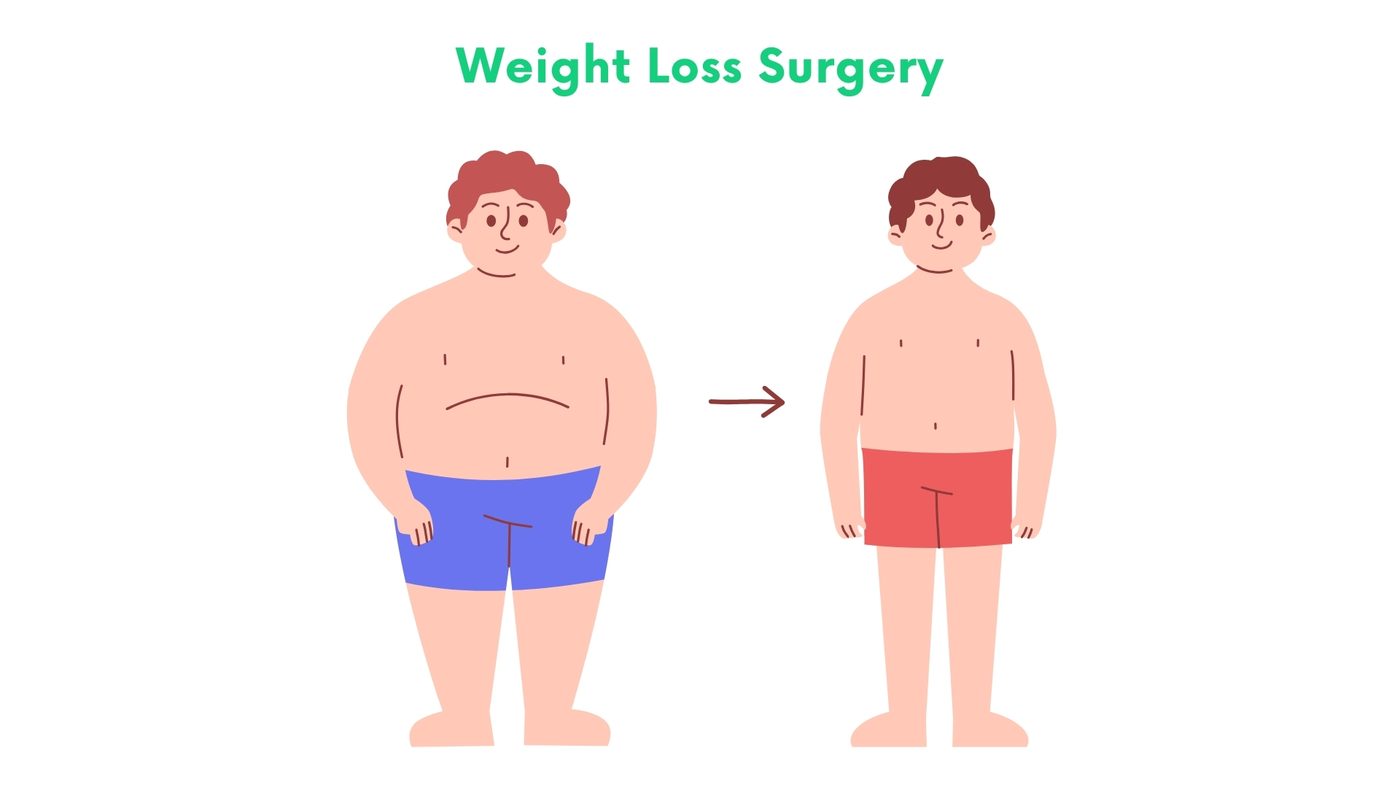 Weight Loss Surgery in Bhakkar by Dr. Shehryar Niazi