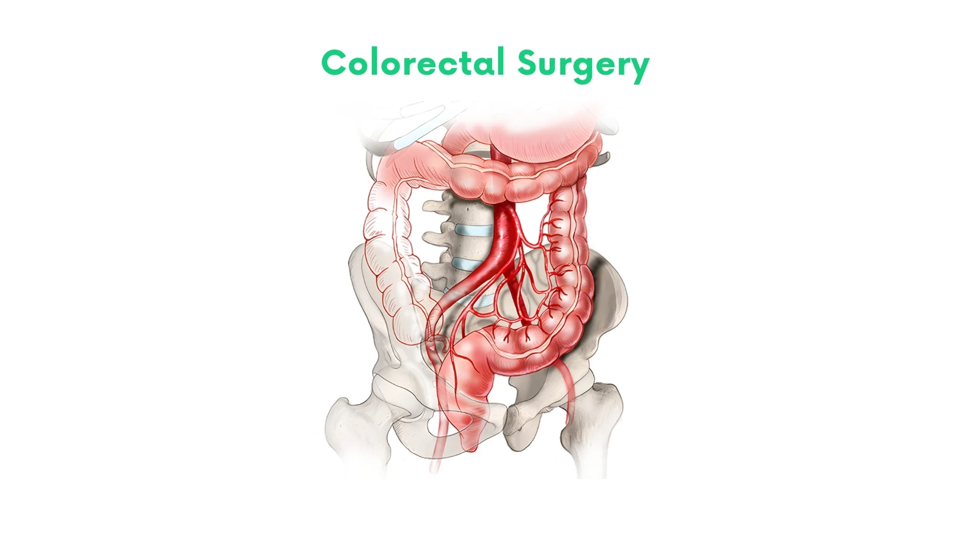 Colorectal Surgery