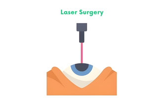 Laser Surgery